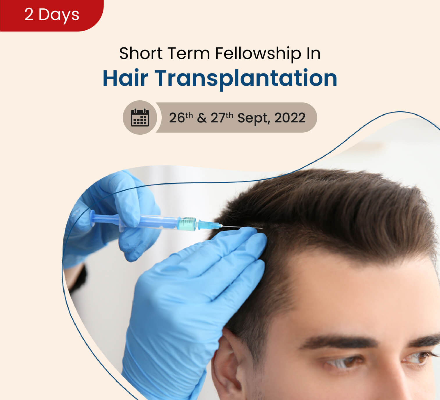 Hair-transplant-02-03